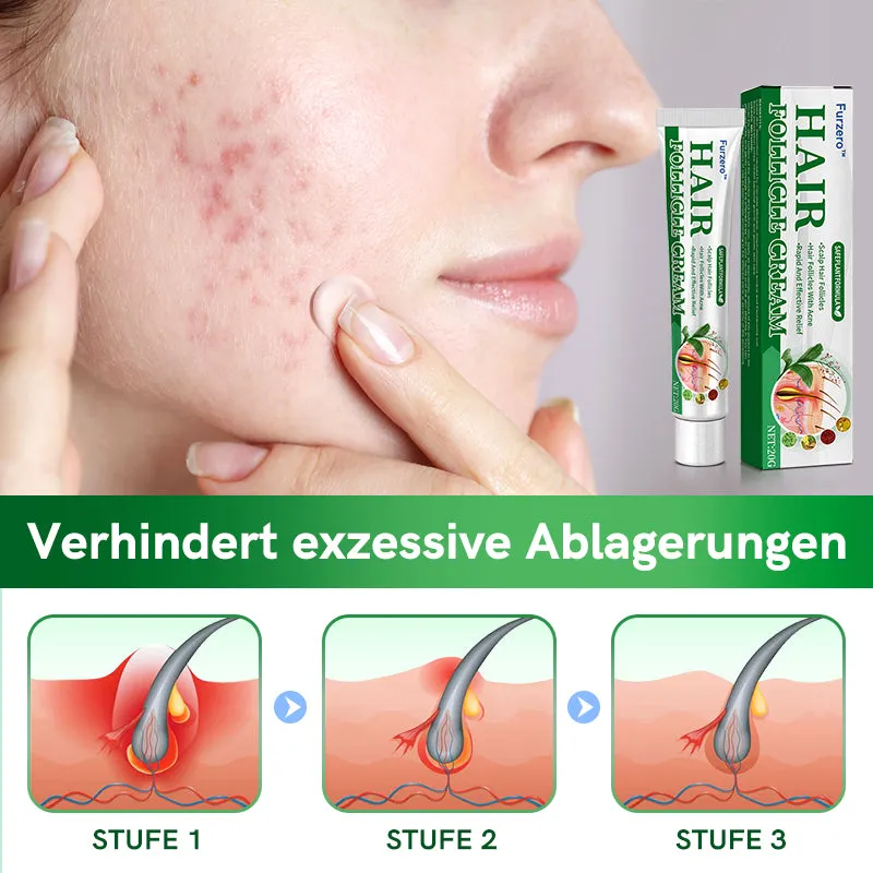 Furzero Follikel Akne Reinigen Creme